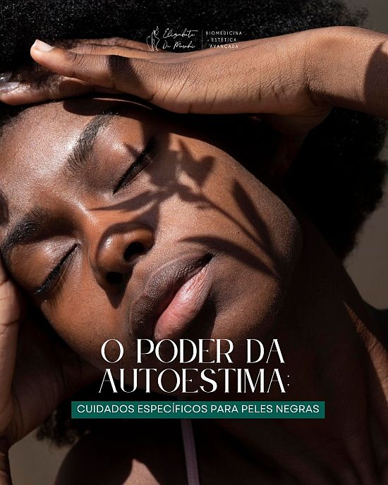 Dra Elizabete De Marchi por image pele negra