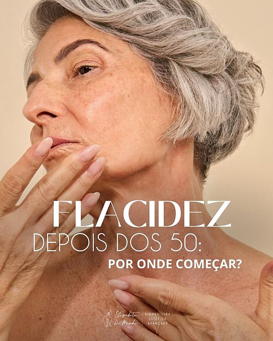 Flacidez depois dos 50: por onde começar? | Clínica de Estética Elizabete De Marchi Dra Elizabete De Marchi flacidez de pele depois dos 50